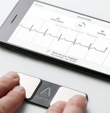 kardial-alivecor-semergen-raul-piedra-ecg