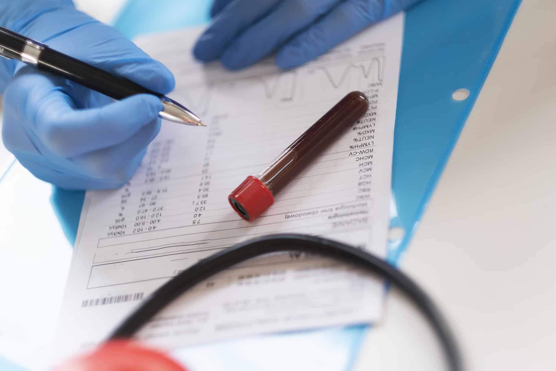 Woman analyzing the results of blood test.